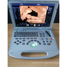 DW-C60plus Portable color doppler fetal ultrasound